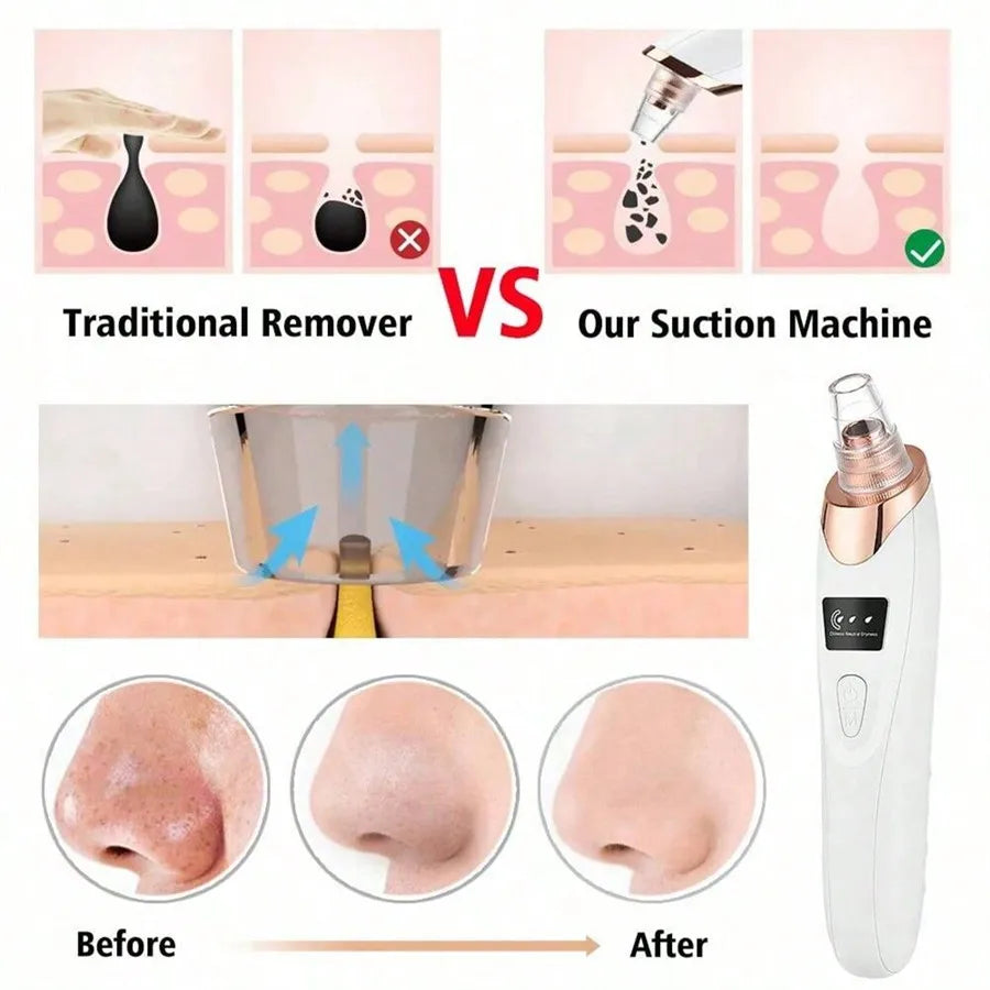 SEP Pore Vacuum Cleaner Professional Blackhead Extractor Tool