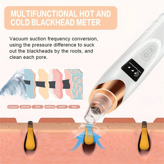 SEP Pore Vacuum Cleaner Professional Blackhead Extractor Tool